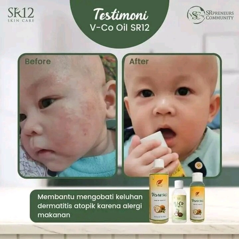 Product image SR12 VCO Minyak Kelapa Murni Mengatasi Ruam Iritasi 60 ml VCO Cair