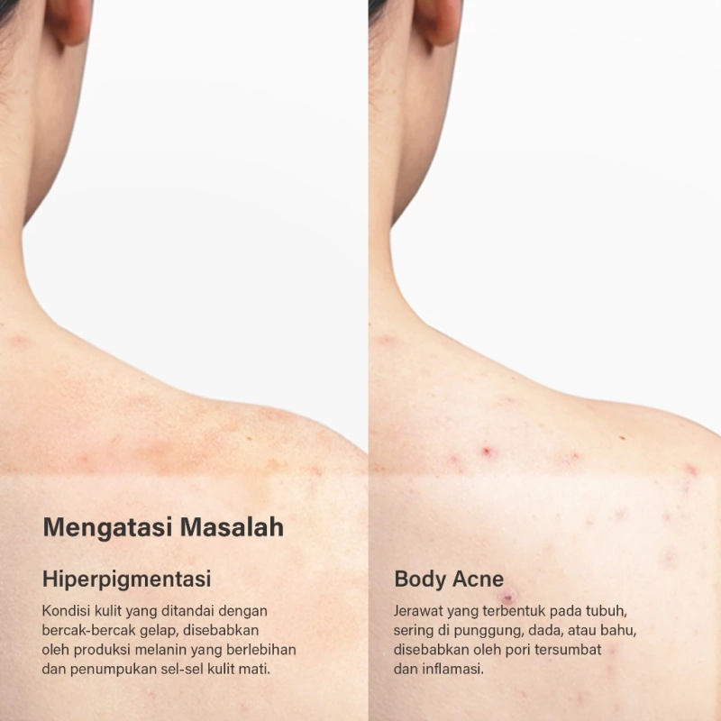 Product image YAGI Forest - YAGI Forest - YAGI Forest - Signature Coffee Scrub 5 gram 5 gram putih