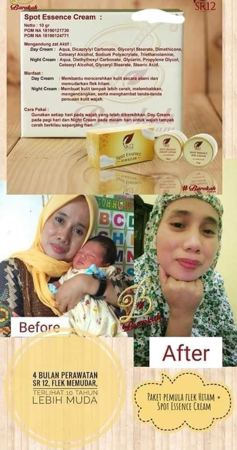 Product image SR12 Spot Cream Essence Day Dan Night Memudarkan Flek Hitam 10 gr Day