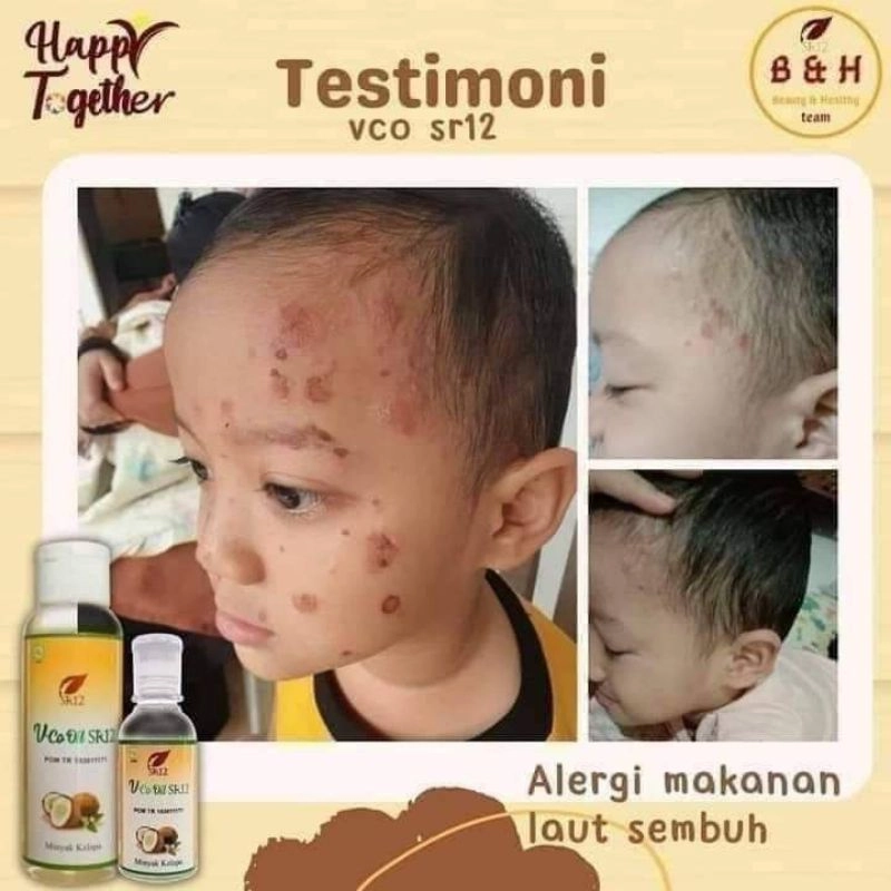 Product image SR12 VCO Minyak Kelapa Murni Mengatasi Ruam Iritasi 60 ml VCO Cair