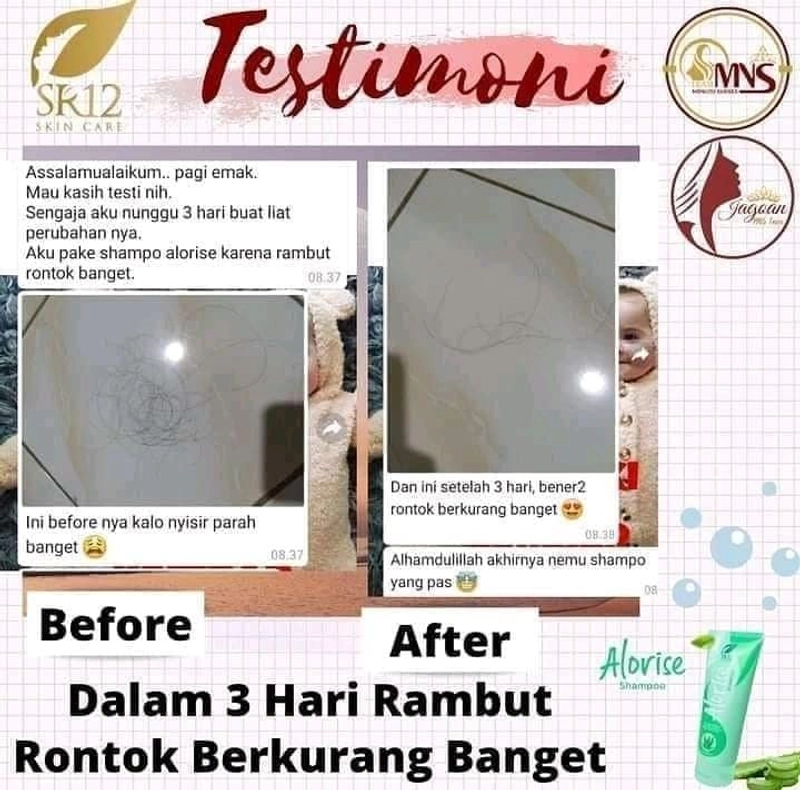 Product image Alorise Shampoo SR12 Shampoo Melebatkan Rambut / Menghitamkan Rambut 100 ml Alorise Shampoo