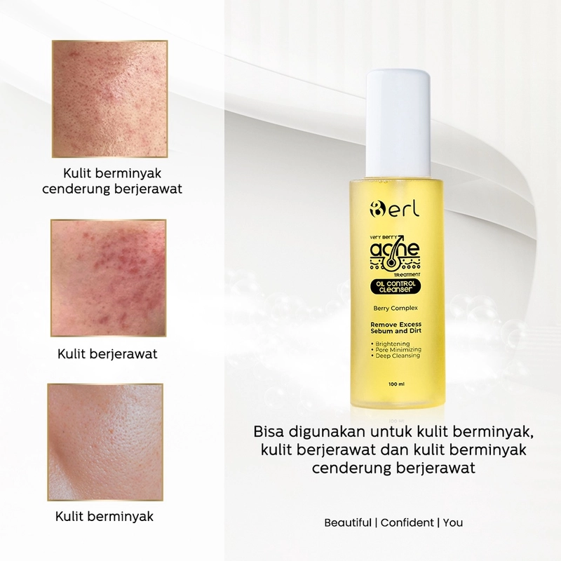 Product image Berl Cosmetics - Very Berry Acne Treatment Oil Control Series 1 Paket Acne Series