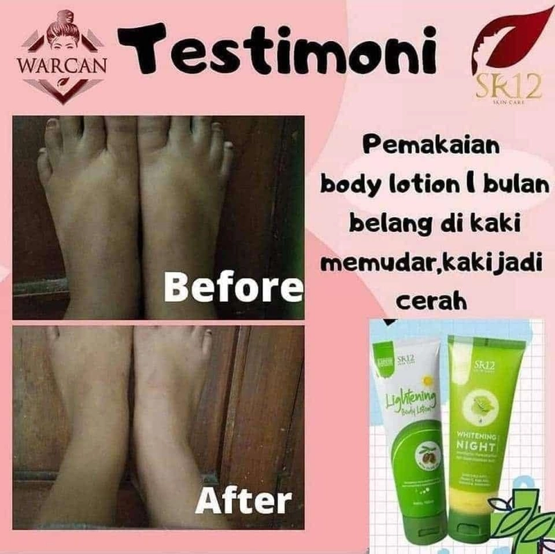 Product image SR12 Lightening Body Lotion SPF 30 PA++ Mencegah Kulit Belang 50 ml Lightening