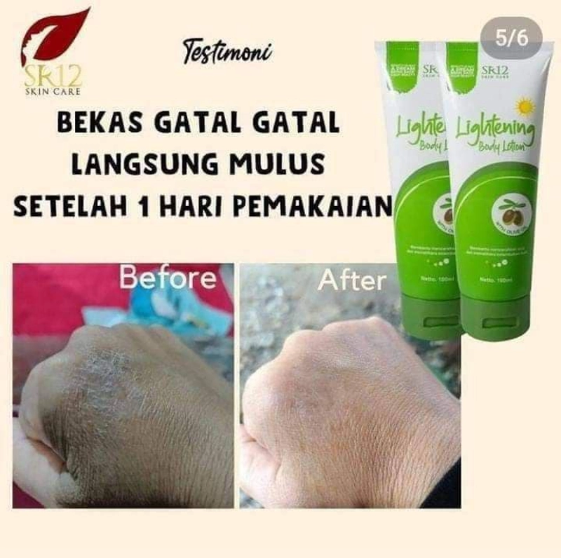 Product image SR12 Lightening Body Lotion SPF 30 PA++ Mencegah Kulit Belang 50 ml Lightening