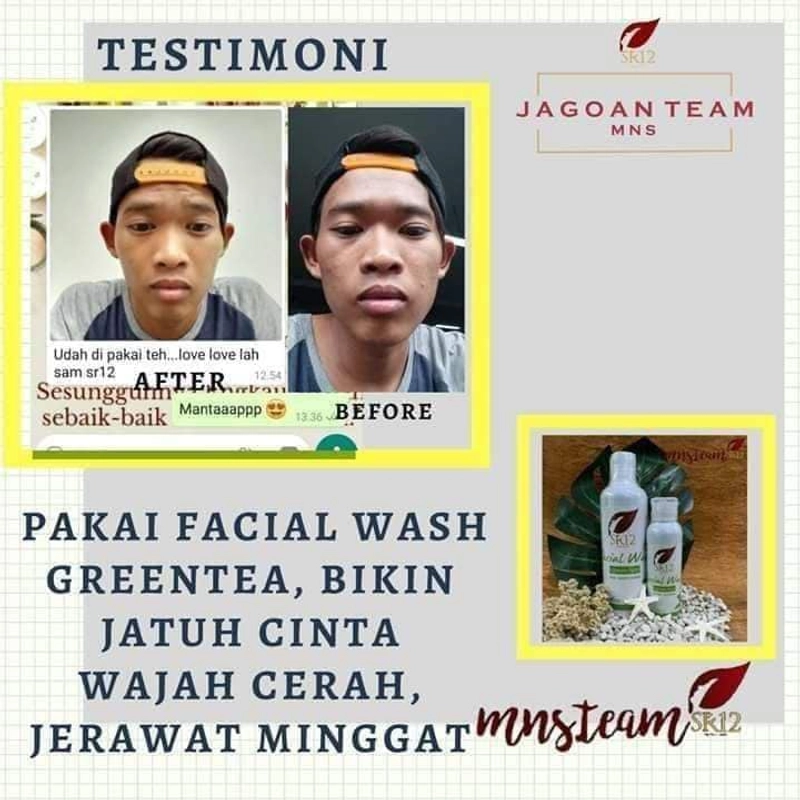 Product image SR12 Facial Wash Greentea Mengatasi Kulit Berminyak Berjerawat 100 ml Facial Greentea Putih