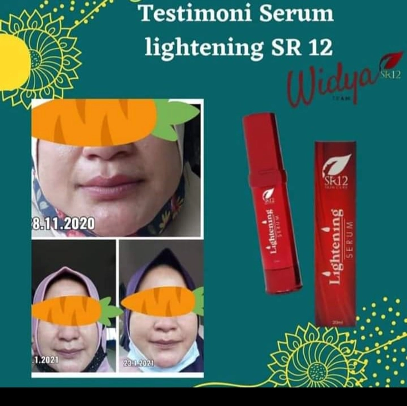 Product image SR12 Serum Lightening Mencerahkan Kulit Dan Memudarkan Flek Hitam 20 ml Lightening Serum