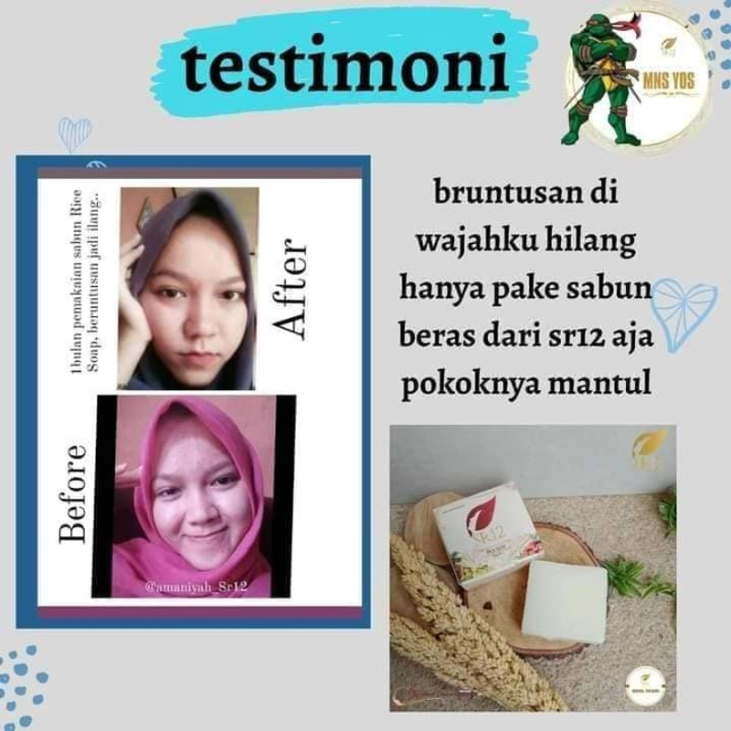Product image SR12 Rice Soap Mengontrol Minyak Berlebih Di Wajah Dan Mengatasi Jerawat Dengan Kandungan Beras 60 gr Rice Soap