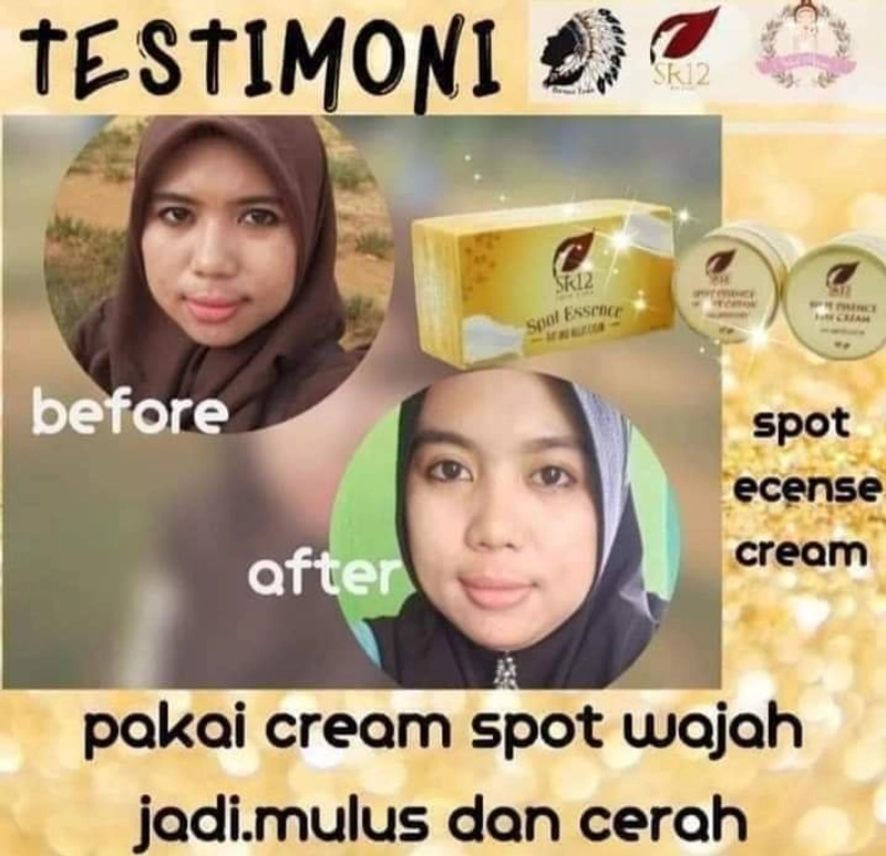 Product image SR12 Spot Cream Essence Day Dan Night Memudarkan Flek Hitam 10 gr Night
