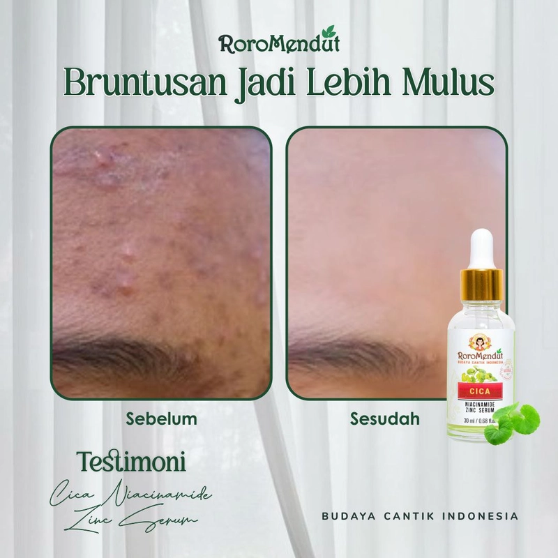 Product image Roro Mendut Skincare - Serum Centella Asiatica Niacinamid Zinc Serum Anti Jerawat 30ml Cica Niacinamid