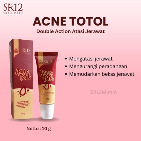 SR12 Acne Totol Mengatasi Jerawat Dengan Double Action Sulfur Dan Salycilic Acid
