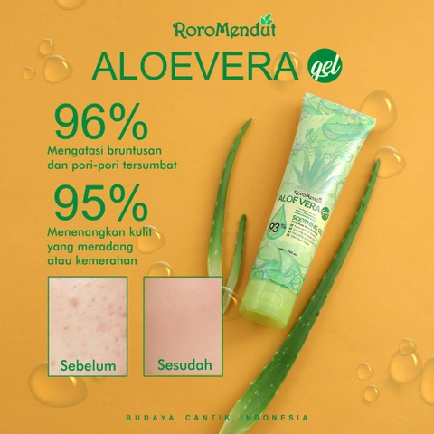 Roro Mendut Skincare - Aloe Vera Shooting Gel Pelembab Alami Multi Fungsi Mengatasi Bruntusan