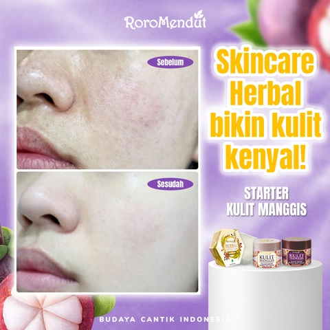 Roro Mendut Skincare - Paket Cream Kulit Manggis Atasi Flek Hitam
